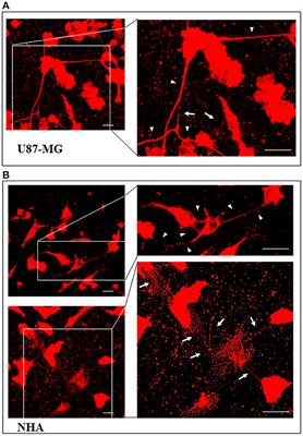 Differential Exchange of Multifunctional Liposomes Between Glioblastoma Cells and Healthy Astrocytes via Tunneling Nanotubes